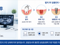 창원 발치 후 임플란트 식립 시기와 치료 과정