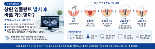 창원 발치 후 임플란트 식립 시기와 치료 과정