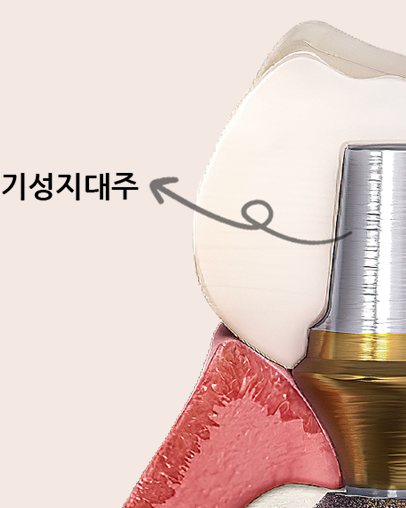 기성 어버트먼트